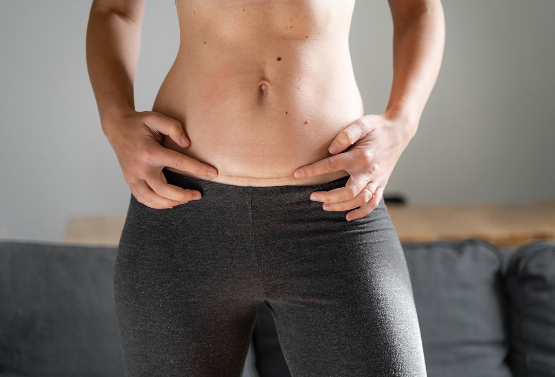Neuromuscular Therapy For Scar Tissue